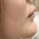 レス2番の画像サムネイル