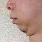 レス2番の画像サムネイル