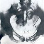 レス6番の画像サムネイル