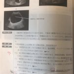 レス11番のサムネイル画像