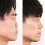 レス1番の画像1