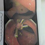 レス23番の画像1