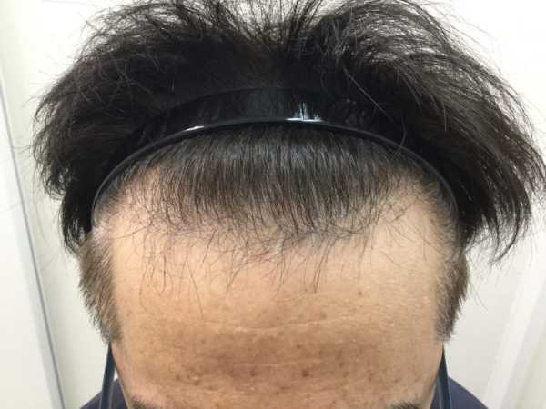 記事サムネイル