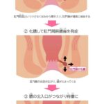 レス47番の画像1